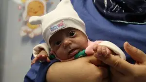 Konya'da 570 gram doğan Ahsen Buğlem bebek hayata tutundu